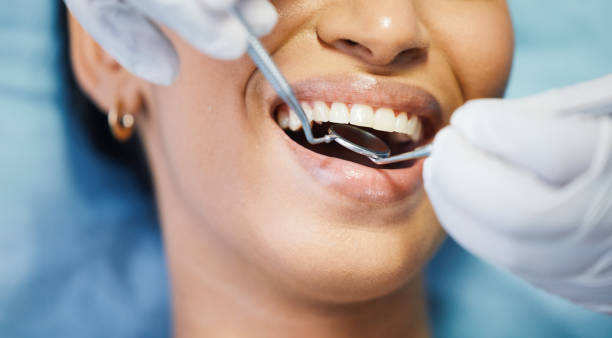 Best Emergency Root Canal Treatment in Brazoria, TX