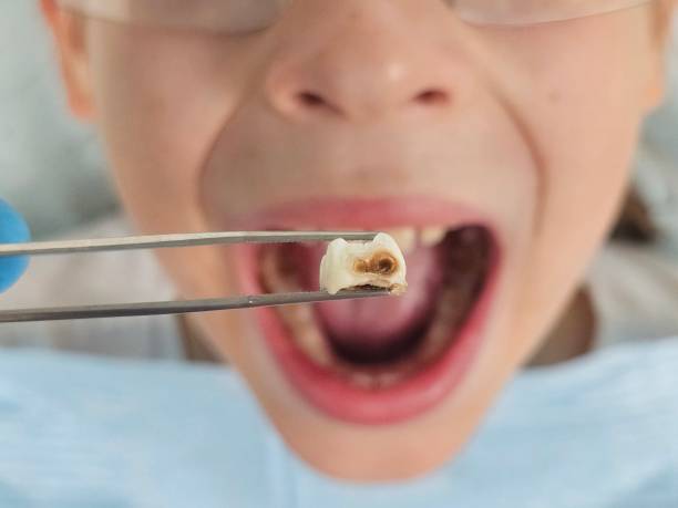 Best 24-Hour Emergency Dentist in Brazoria, TX
