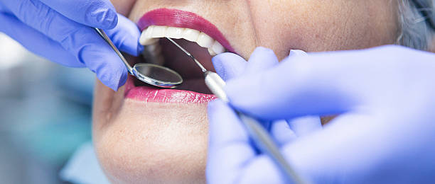 Best Emergency Wisdom Teeth Removal in Brazoria, TX