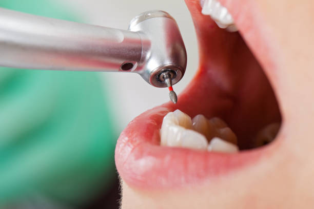 Best 24-Hour Emergency Dentist in Brazoria, TX
